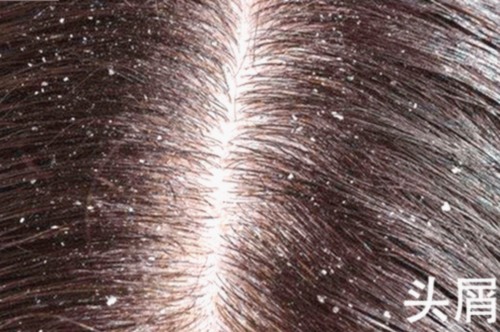 吃瓜每日大赛热议：mrds校园大赛背后那些你没注意的反差与真相🍿